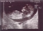 991122_BabyShotSize_tiny.jpg (5059 bytes)